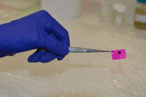A flexible polymer patch has been shown to improve the conduction of electrical impulses across damaged heart tissue in animals. The patch can be attached to the heart without the need for stitches. Photo: University of New South Wales. 