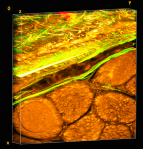 Periosteum is a tissue fabric layer on the outside of bone, as seen in the upper diagonal segment of the tissue image volume. The natural weave of elastin (green) and collagen (yellow) are evident when viewed under the microscope. Elastin gives periosteum its stretchy properties and collagen imparts toughness. Muscle is organized into fiber bundles, observed as round structures in the lower diagonal segment of the tissue image volume. The volume is approximately 200 x 200 microns (width x height) x 25 microns deep. Photo: Melissa Knothe Tate.